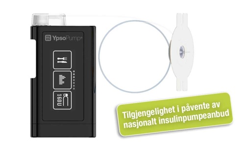 mylife YpsoPump insulinpump